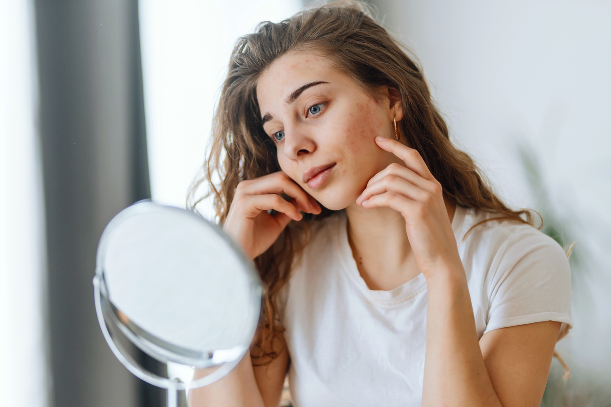 A pretty young girl examines her acne outbreak in a vanity mirror in her bedroom on a bright day