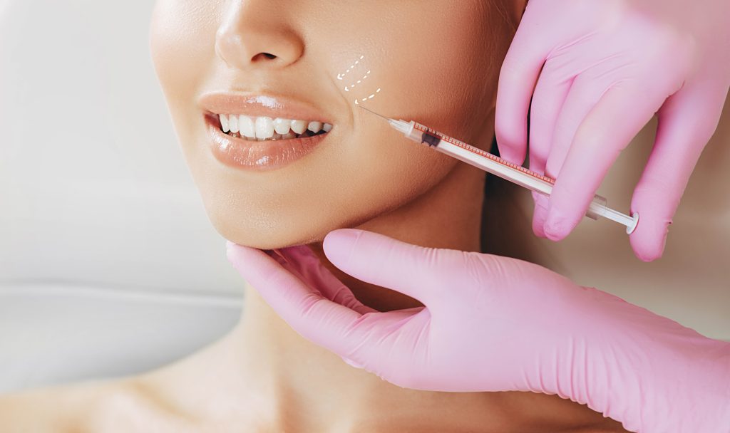 A women receiving an HA filler injectable to address smile lines.