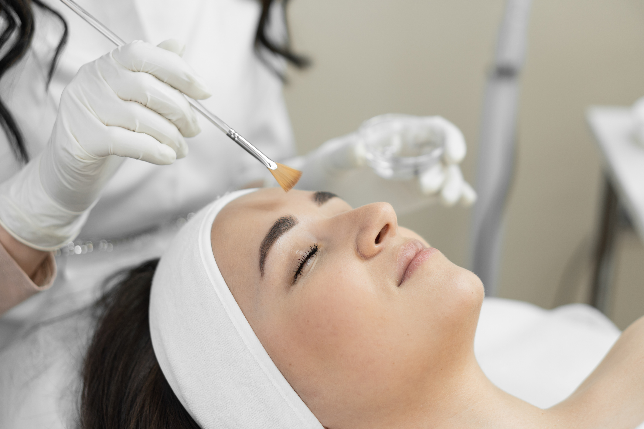 Learn how a VI Peel works to improve acne, fine lines, and hyperpigmentation with minimal downtime and discover what results you can expect.